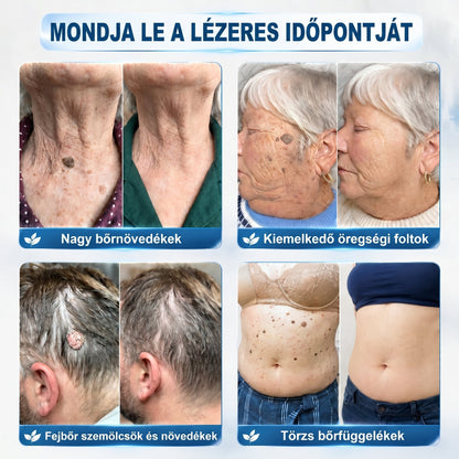 🏥🎁𝐏𝒊𝐜𝐝𝒐® 7 𝑵𝒂𝒑𝒐𝒔 𝑩ö𝒓𝒌𝒊𝒏ö𝒗é𝒔- É𝒔 𝑭𝒐𝒍𝒕𝒆𝒍𝒕á𝒗𝒐𝒍í𝒕ó