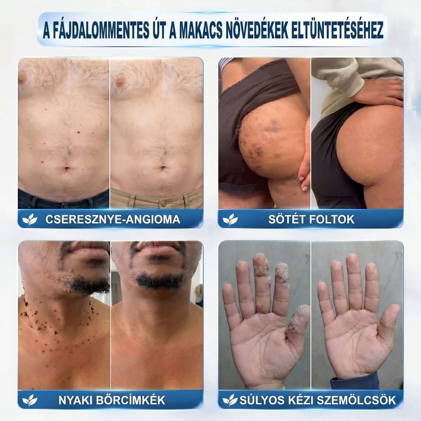 🏥🎁𝐏𝒊𝐜𝐝𝒐® 7 𝑵𝒂𝒑𝒐𝒔 𝑩ö𝒓𝒌𝒊𝒏ö𝒗é𝒔- É𝒔 𝑭𝒐𝒍𝒕𝒆𝒍𝒕á𝒗𝒐𝒍í𝒕ó